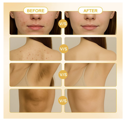 Lemon Turmeric Kojic Soap Bar for All Skin Types