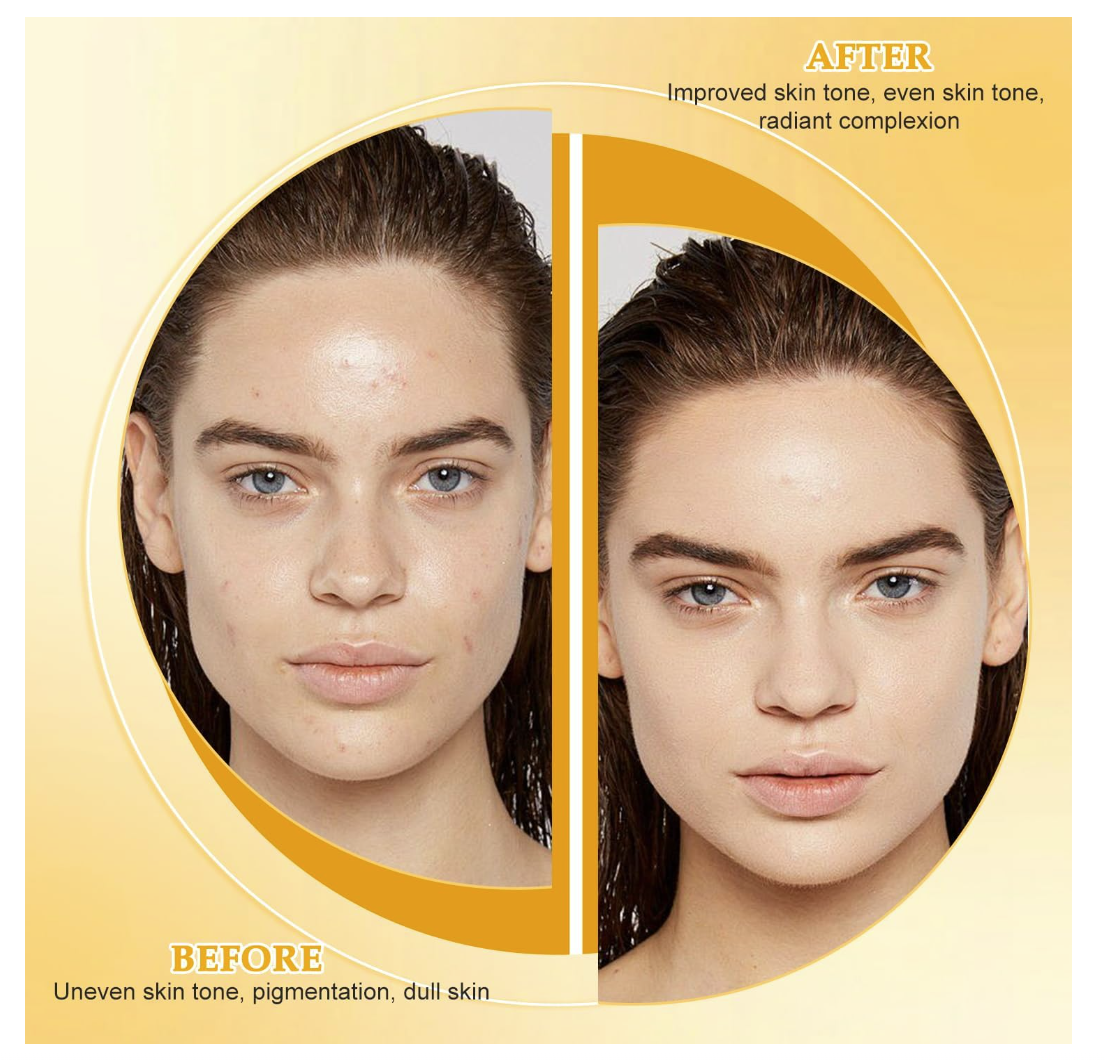 Lemon Turmeric Kojic Soap Bar for All Skin Types