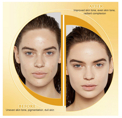 Lemon Turmeric Kojic Soap Bar for All Skin Types