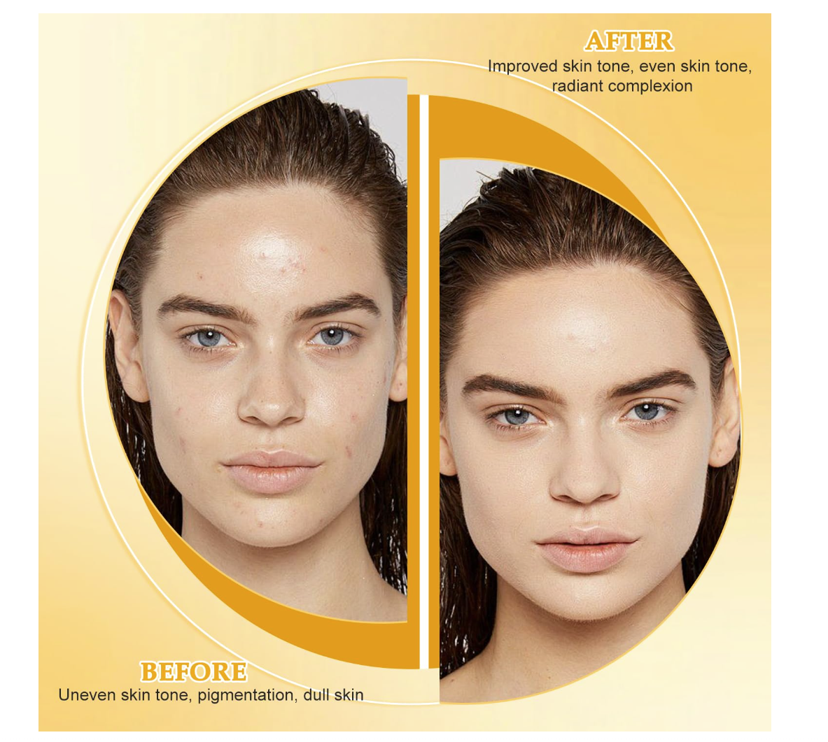 Lemon Turmeric Kojic Soap Bar for All Skin Types